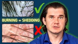 Why Your Hair Loss Routine Is Destroying Your Scalp Barrier
