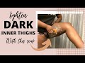 SECRETS TO GET RID OF DARK INNER THIGHS, DARK KNEES!!