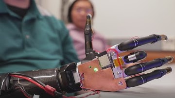 U Of M Researchers Develop Bionic Arms