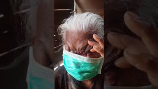 Peduli anak yatim boyolali..mbah jinem kanker wajah ..kemusu boyolali