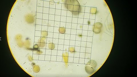 Moment of Science: How Pollen is Counted