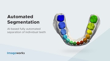 Automated Teeth Segmentation | Imagoworks Technology (2021 Sep)