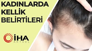 Kadınlarda Kellik Belirtileri ve Tedavisi