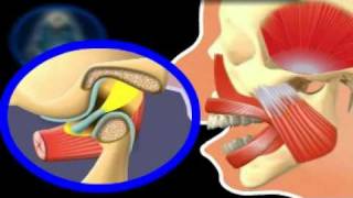 Clicking Of The Jaw Youtube