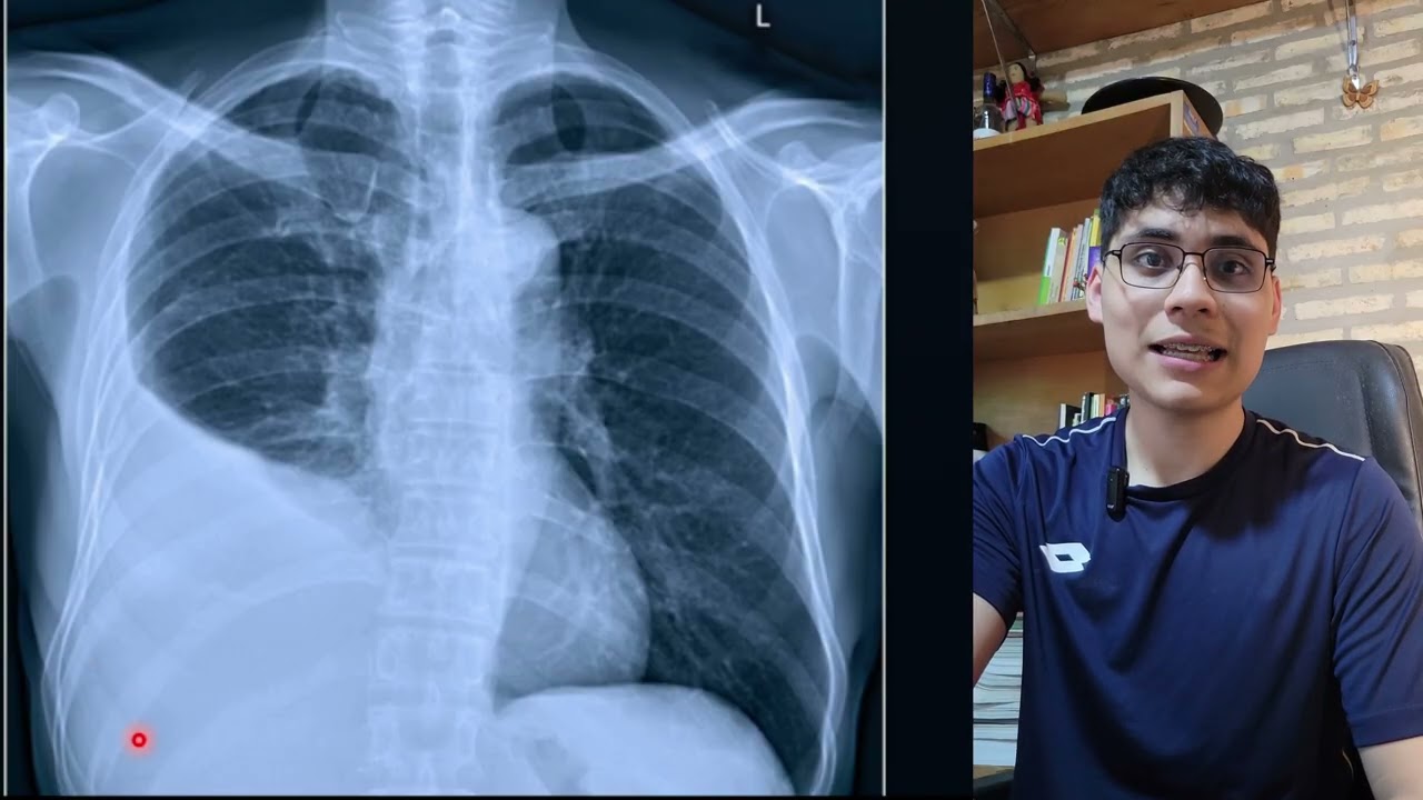 Cómo describir una radiografía de tórax | Guía paso a paso para estudiantes de medicina