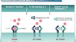 The JAK/STAT Pathway in Rheumatoid Arthritis