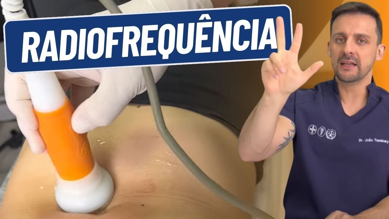 COMO APLICAR RADIOFREQUÊNCIA | DR. JOÃO TASSINARY