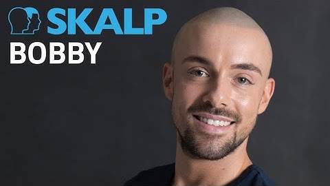 How real does scalp micropigmentation look? Watch Bobby’s video to see his amazing results!