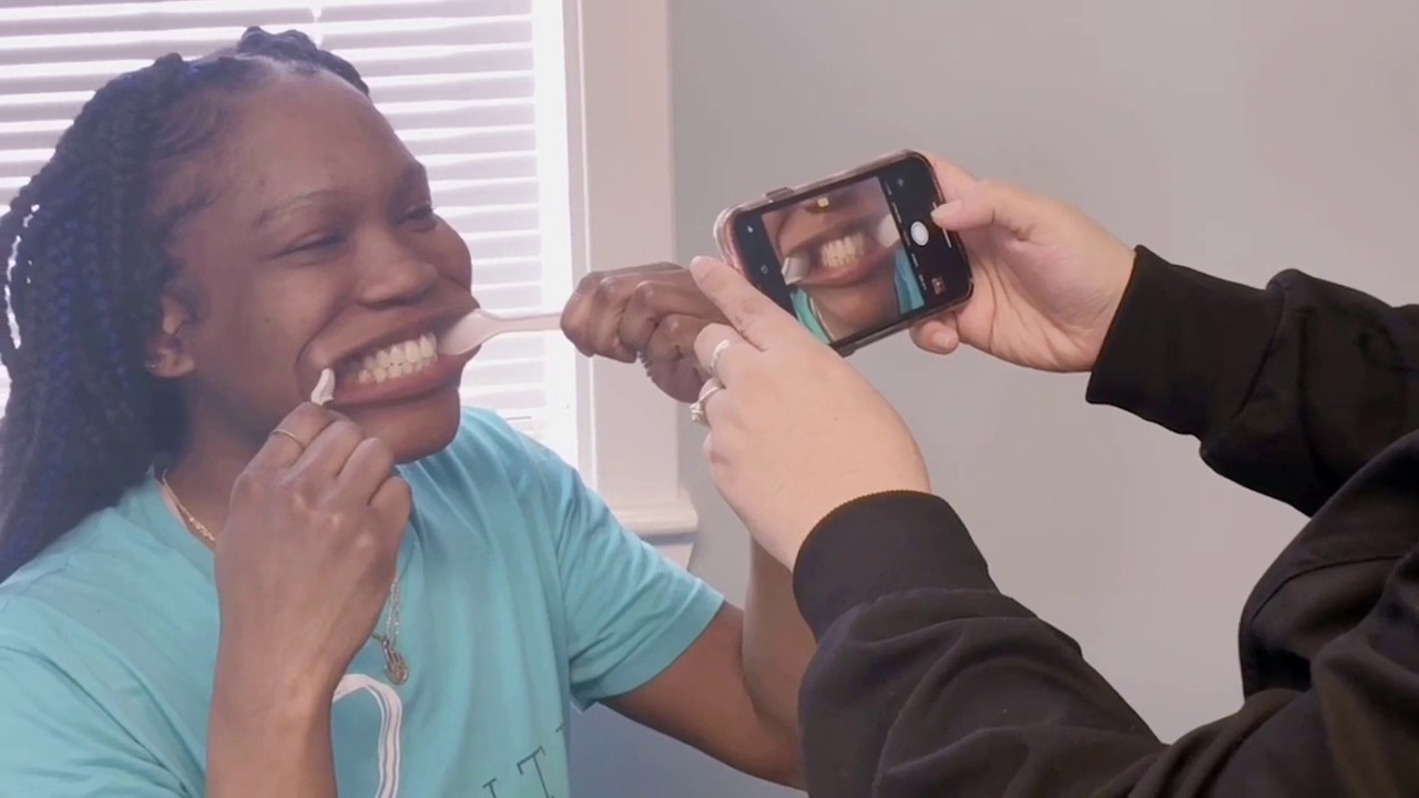 Elite Orthodontics Best Orthodontist in Bowie, MD Invisalign