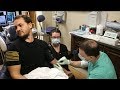 Painless IV Starts in Sedation Dentistry