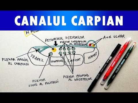 inflamația carpului