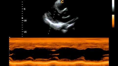 Qbit Cardiac Function