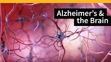 Wo fängt Alzheimer an?