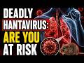 This Rare Virus Can Destroy Your Lungs Fast | Hantavirus Explained
