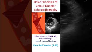 Basic Principles of Colour Doppler Echocardiography