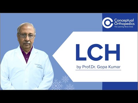 LCH by Prof. Gopa Kumar @Conceptual Orthopedics