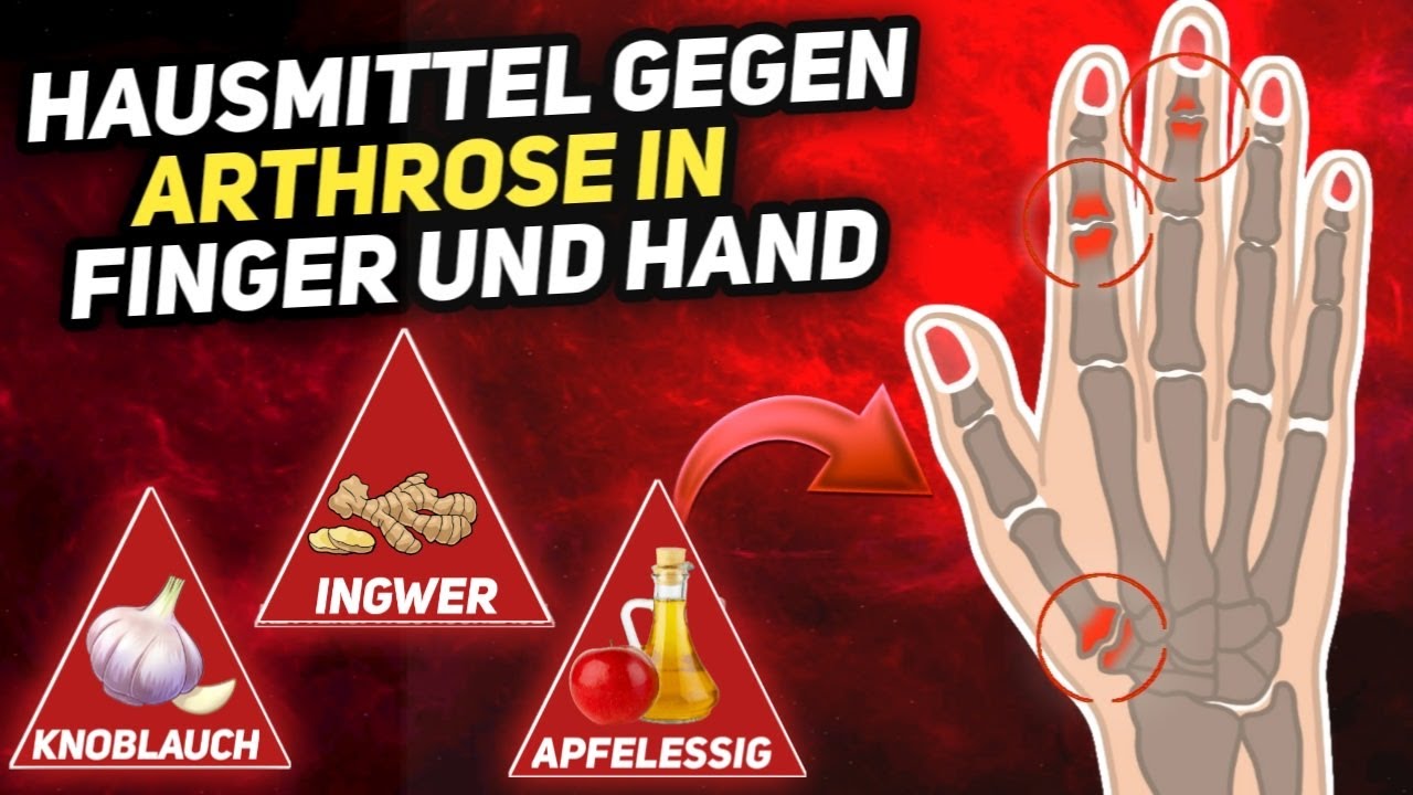 7-nat-rliche-hausmittel-gegen-arthrose-in-finger-und-hand-youtube