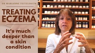 Treating Eczema: It's much deeper than a skin condition.