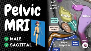 Male Pelvis MRI Anatomy | Sagittal View Explained