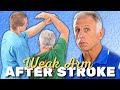 Top 3 Exercises for Weak Arm After Stroke (Simple Do-It-Yourself)