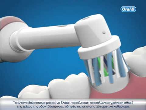 Βίντεο: Μπορεί η οδοντόβουρτσα Sonic να βλάψει τα δόντια;