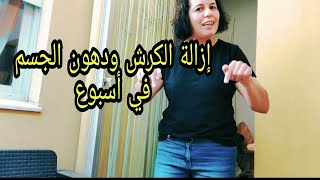 نقصت 10كيلو في أسبوعأسرع طريقة لإنقاص الوزن الزائد بدون ريجيم