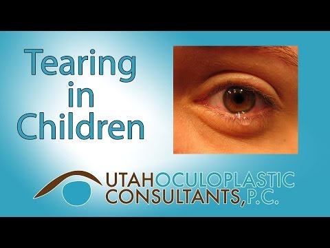 Tearing in children (blocked tear ducts)