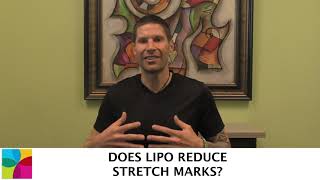 Famous Does Lipo Reduce Stretch Marks? Profile