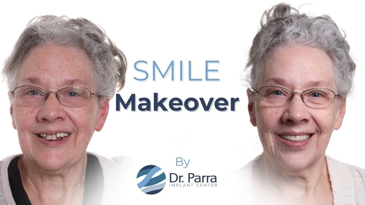 Dr. Parra Experience - Linda Williamson