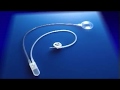 AMS800 人工尿道括約筋　手術手技ビデオ（会陰部アプローチ）(医療従事者向け）