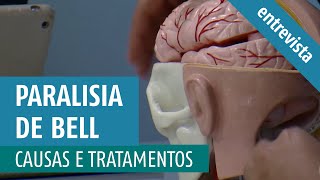 Paralisia de Bell (Paralisia Facial Periférica): Causas e Tratamentos (Entrevista TV Aparecida)