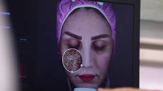 الحل الامثل لتشخيص مشاكل البشرة جهاز تحليل البشرة الرقمي (فيزيا) screenshot 5