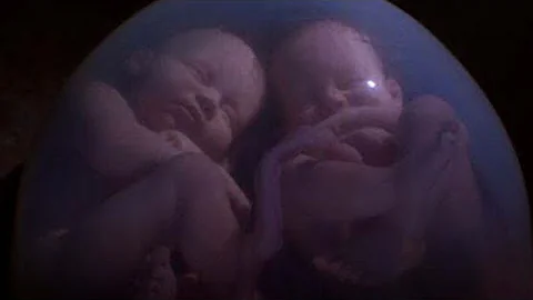 Is it normal for twins to fight in the womb?