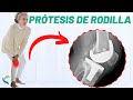 Operación de PRÓTESIS DE RODILLA: resolvemos tus dudas ⚠️