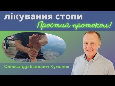 ЛІКУВАННЯ СТОПИ |