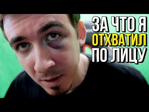 Видео: ВОТ ЗА ЧТО МНЕ НАБИЛИ ЛИЦО