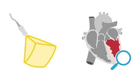 Analyzing the left ventricle using 3D echocardiography