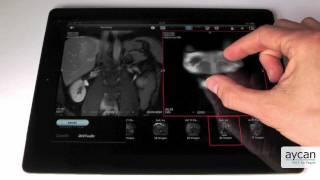 aycan mobile iPad App for PACS / Teleradiology screenshot 1