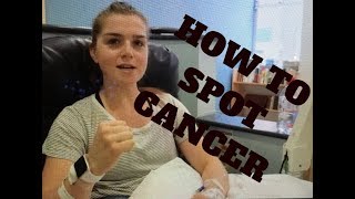 HOW I FOUND MY SKIN CANCER | SIGNS AND SYMPTOMS TO LOOK FOR