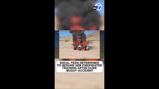 SoCal teen determined to recover from severe burns, become firefighter