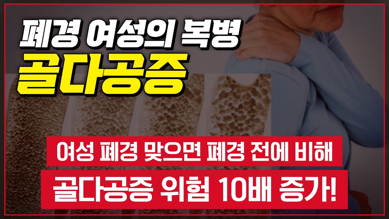 젊은 층에서도 발병한다는 '골다공증' ,  재활의학과? 내분비대사내과?     [ TV닥터인사이드 ] 20151025