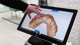 3D Digital Scanning - Designing and Printing Your New Tooth - Dental Implant Studio Technology