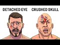 The Most Painful Injuries In MMA History