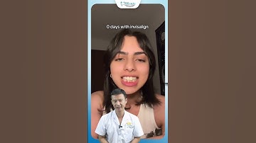 Hành Trình Niềng Răng Khấp Khểnh Với Khay Invisalign | Nha Khoa Minh Châu