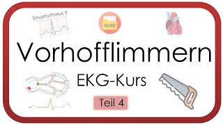 Vorhofflimmern sicher erkennen - EKG auswerten leicht gemacht (Tachyarrhythmia absoluta, EKG-Kurs)