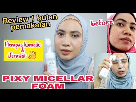 REVIEW JUJUR PIXY TERBARU WHITE AQUA SERIES DIKULIT BERJERAWAT (ACNE-PRONE).. 