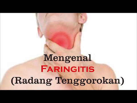 Video: Bagaimana Anda Boleh Berkumur Dengan Faringitis?