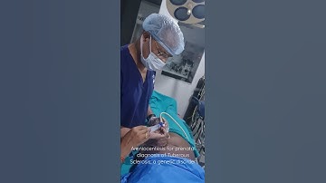 Amniocentesis@idealfertility 2