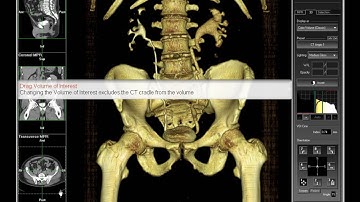 Tips & Tricks Video: Creating a 3D CT Urography View