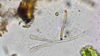 Planktonic Chrysophyte ?